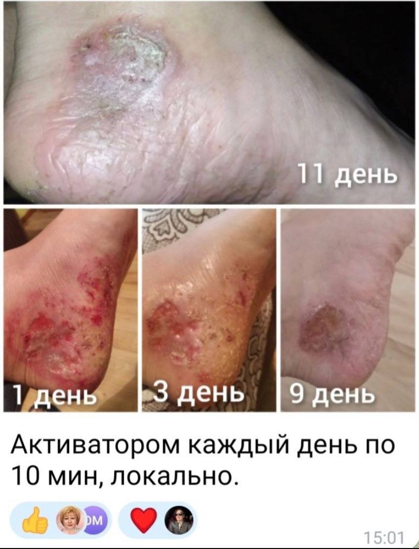 Отзыв клиента Whieda 1