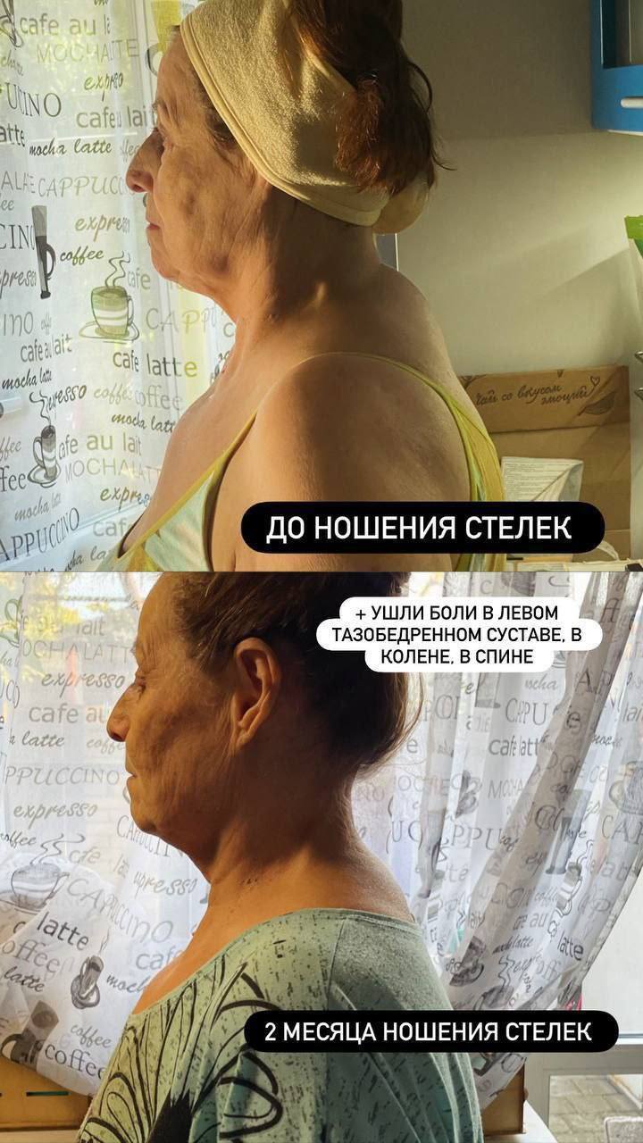 Отзыв клиента Whieda 2