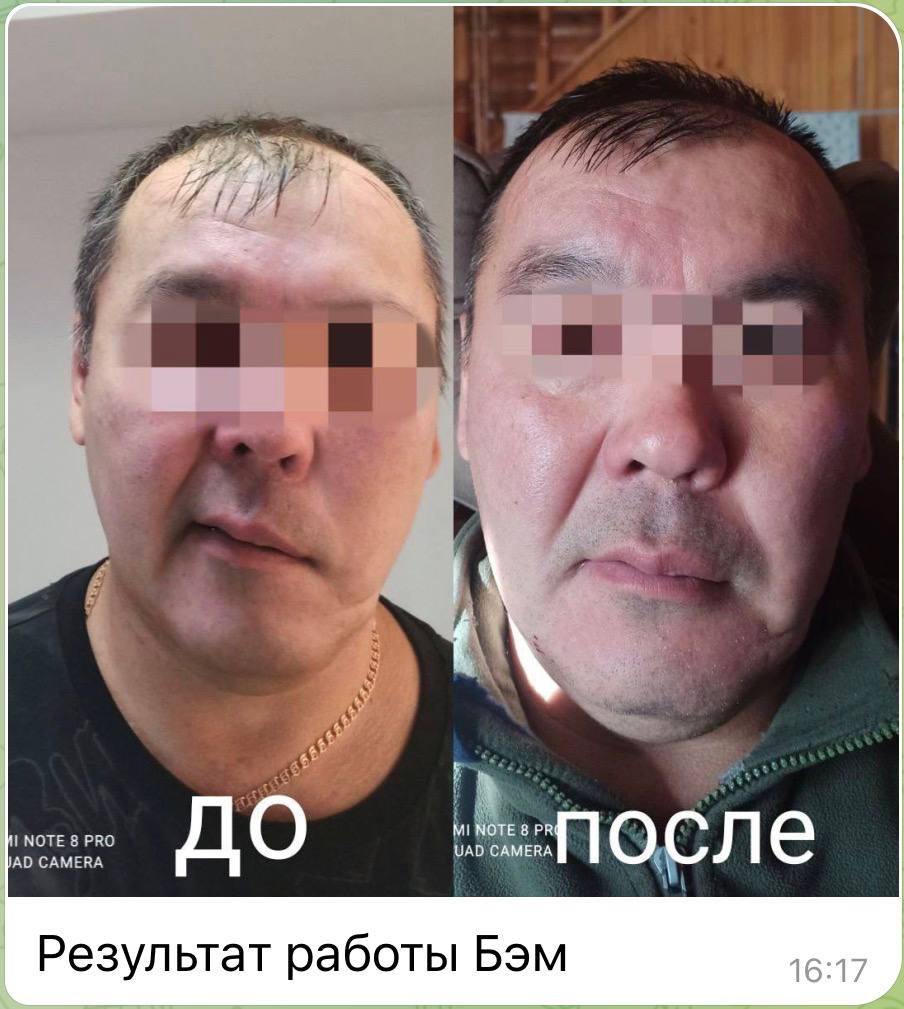 Отзыв клиента Whieda 3