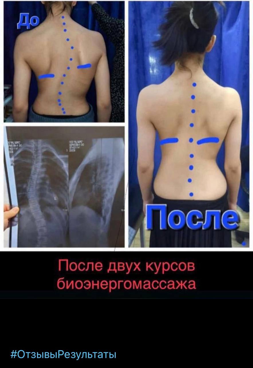 Отзыв клиента Whieda 4