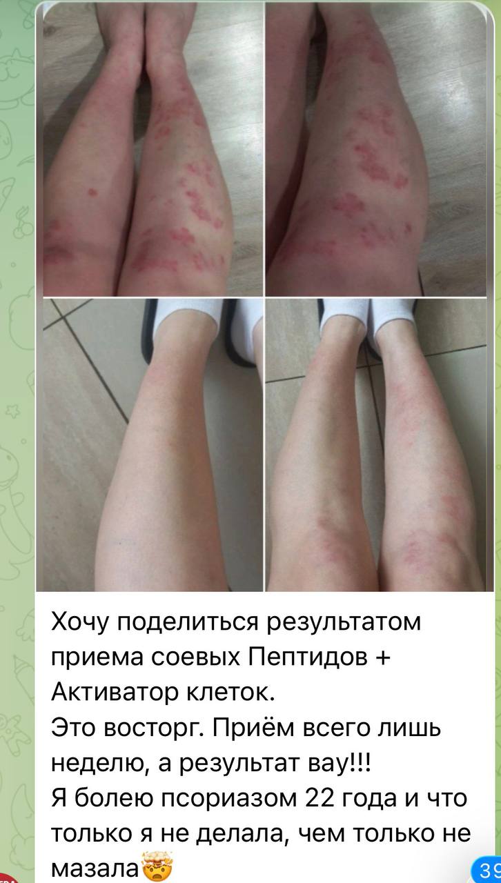 Отзыв клиента Whieda 5