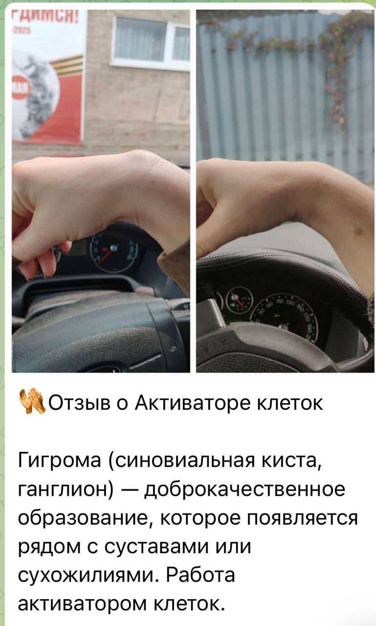 Отзыв клиента Whieda 6