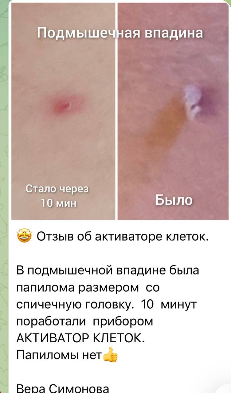 Отзыв клиента Whieda 7