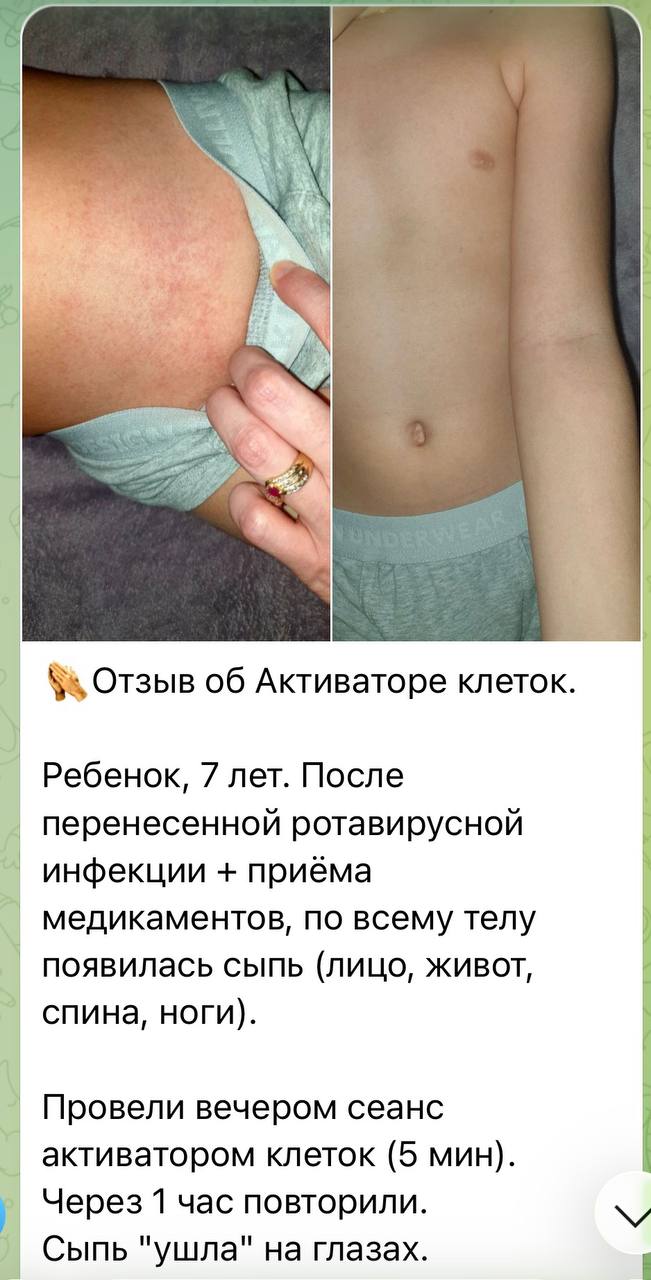 Отзыв клиента Whieda 9